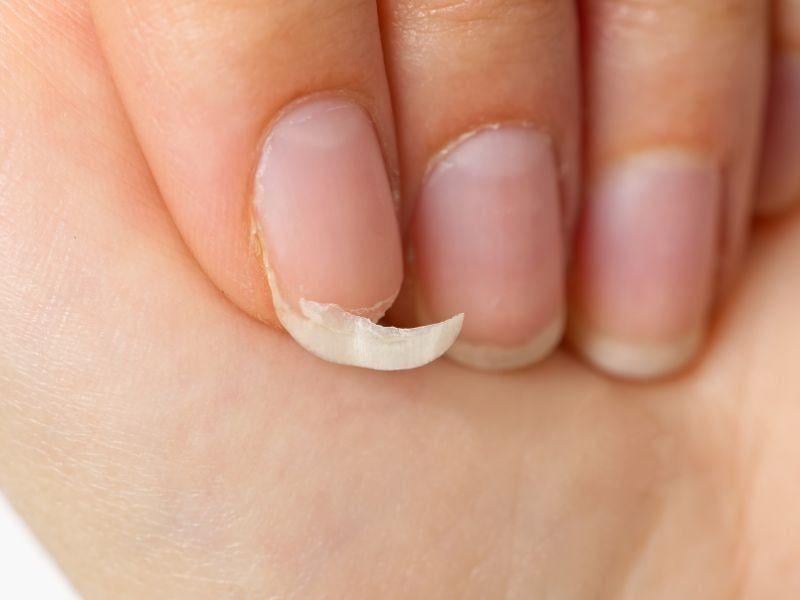 mo thay mong tay bi gay la diem gi may man hay canh bao dieu khong tot 6