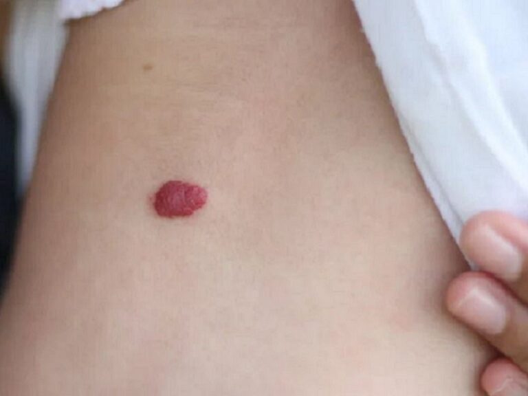 y nghia vet bot mau do va giai ma van menh an chua trong dau an dac biet 0 1