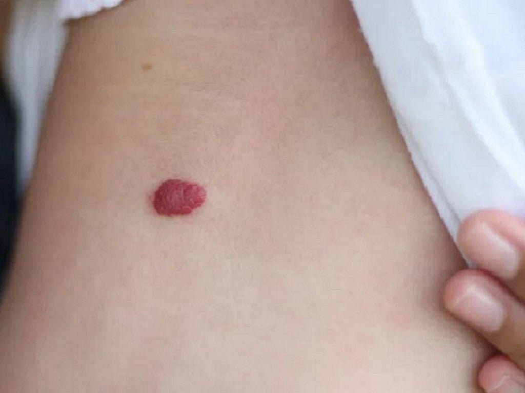 y nghia vet bot mau do va giai ma van menh an chua trong dau an dac biet 0 1