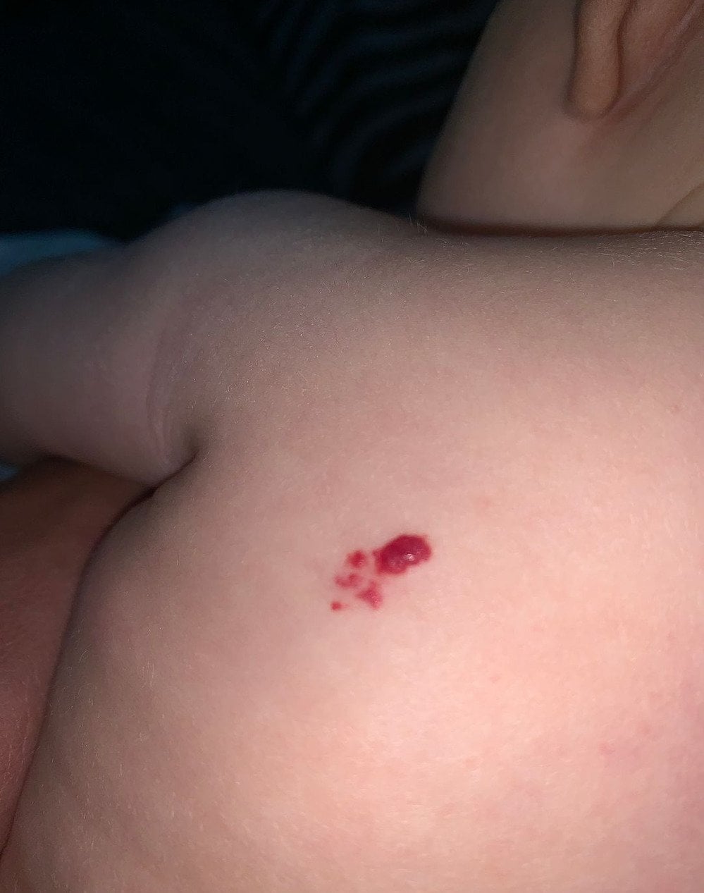 y nghia vet bot mau do va giai ma van menh an chua trong dau an dac biet 4