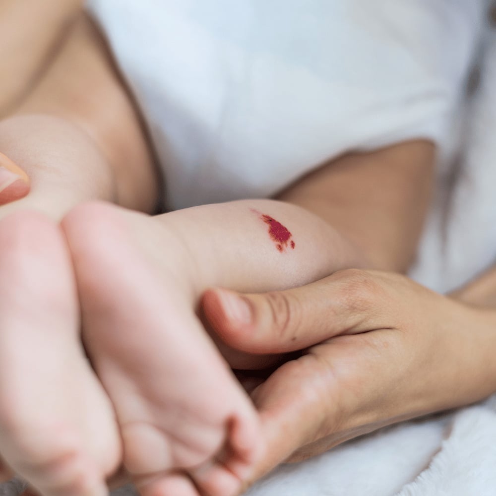 y nghia vet bot mau do va giai ma van menh an chua trong dau an dac biet 5