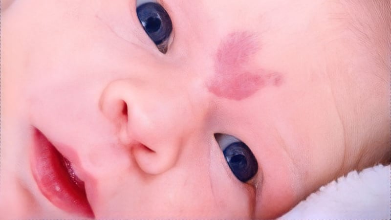 y nghia vet bot mau do va giai ma van menh an chua trong dau an dac biet 6