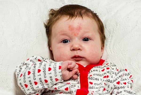 y nghia vet bot mau do va giai ma van menh an chua trong dau an dac biet 8